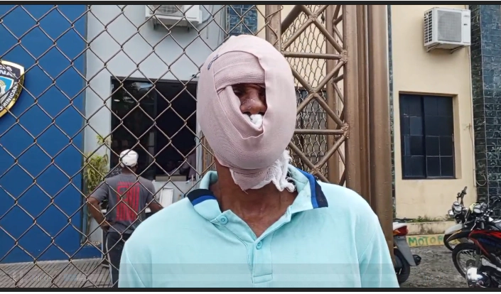 Lanzan sancocho caliente a hombre por RD$200 en La Vega